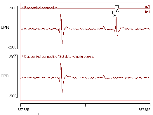Expanded view of remove template match